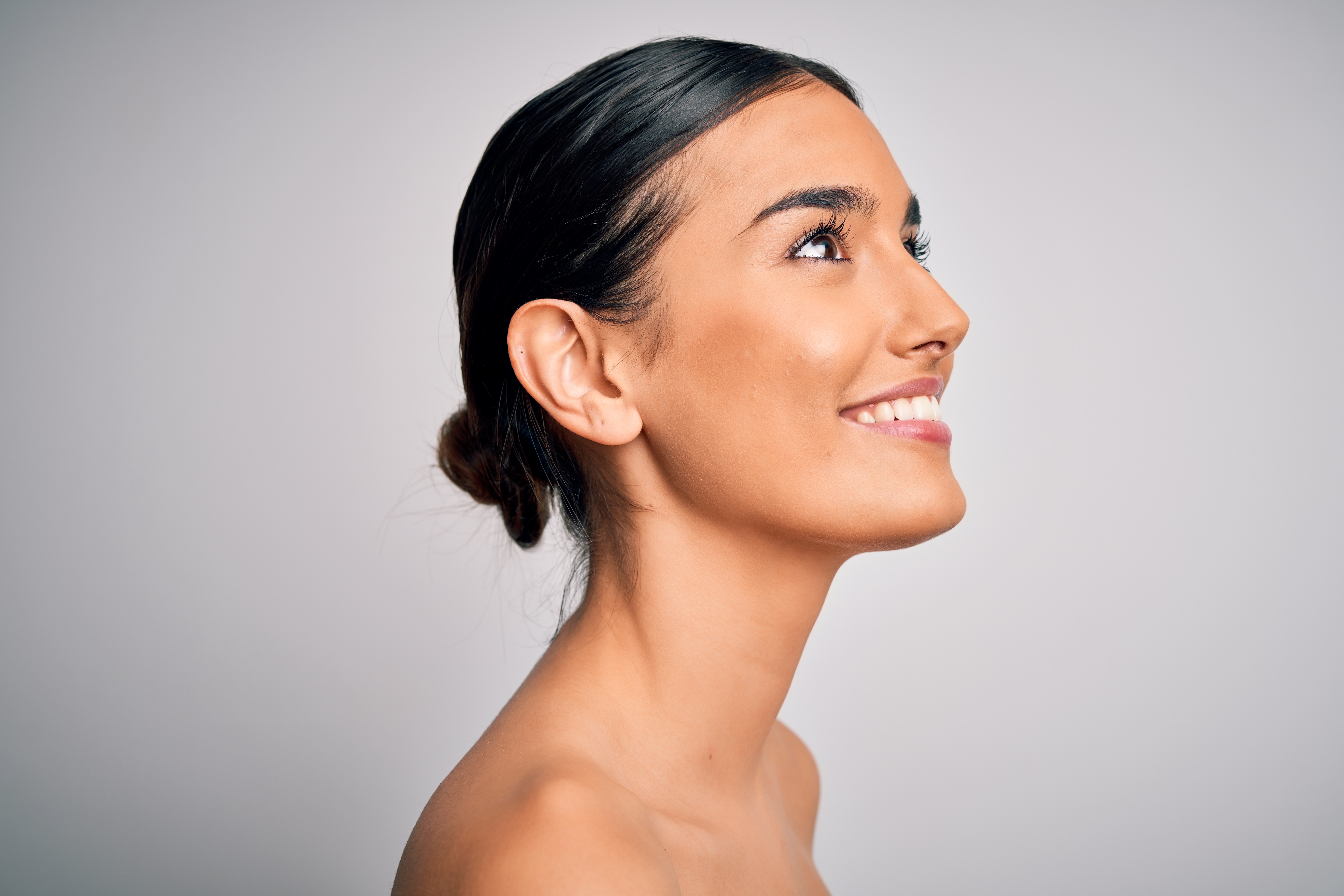Chin liposuction, or submental liposuction, targets the area beneath the chin and along the jawline.