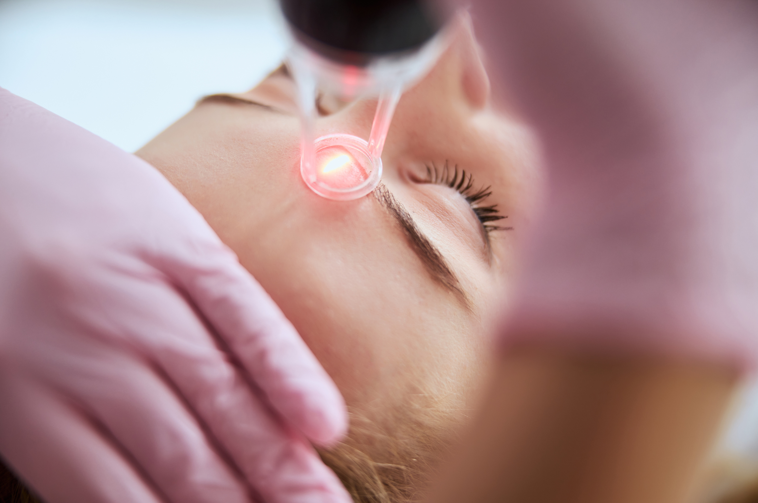 CO2 laser treatment is a powerful skin rejuvenation solution that reverses signs of aging by smoothing fine lines, wrinkles, and scars while stimulating collagen production. Discover how this gold standard treatment can restore a youthful, vibrant complexion and learn what to expect before, during, and after the procedure.